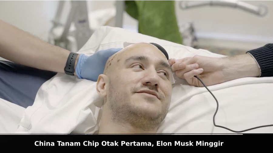 Tanam Chip Otak
